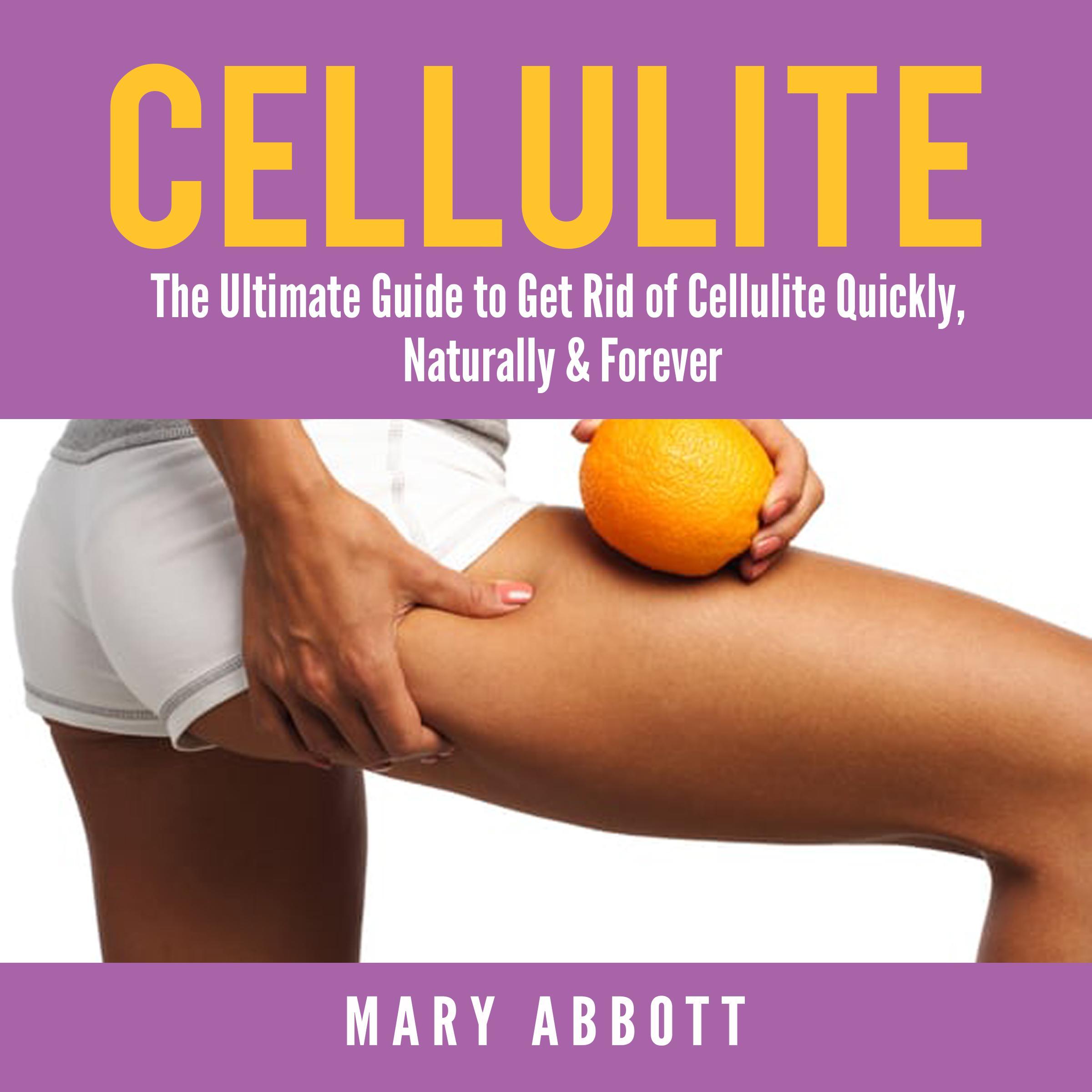 Cellulite