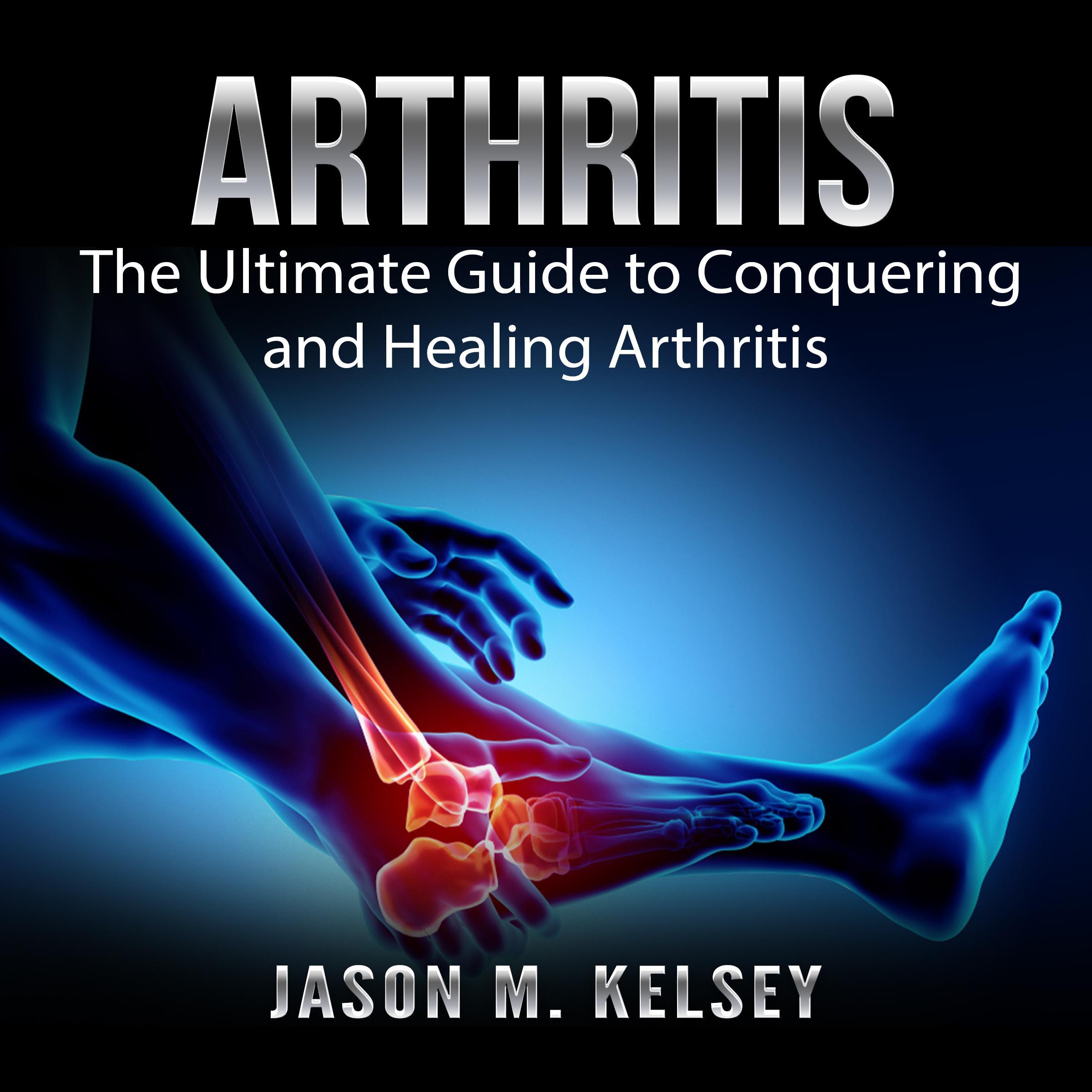 Arthritis