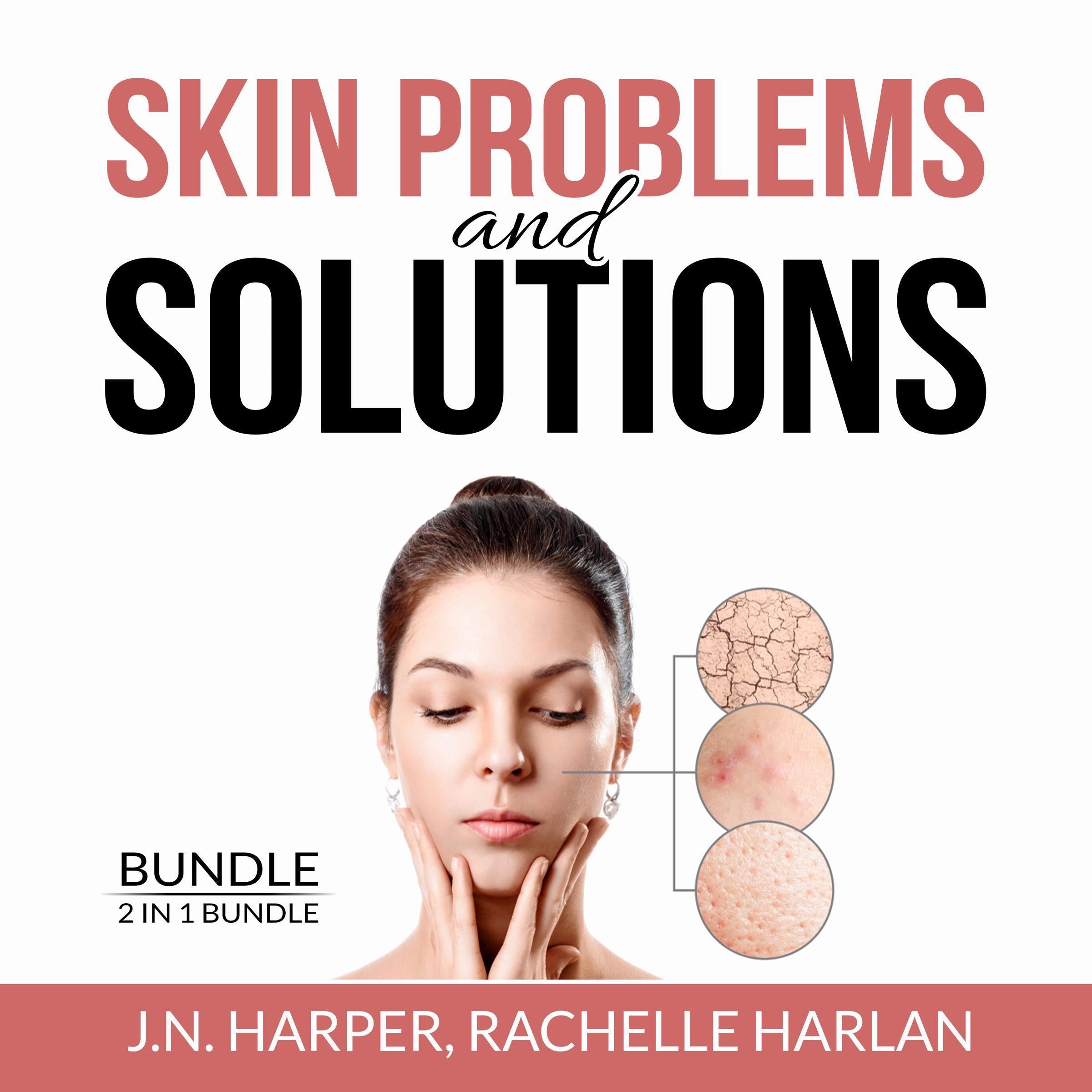 Skin Problems and Solutions Bundle: