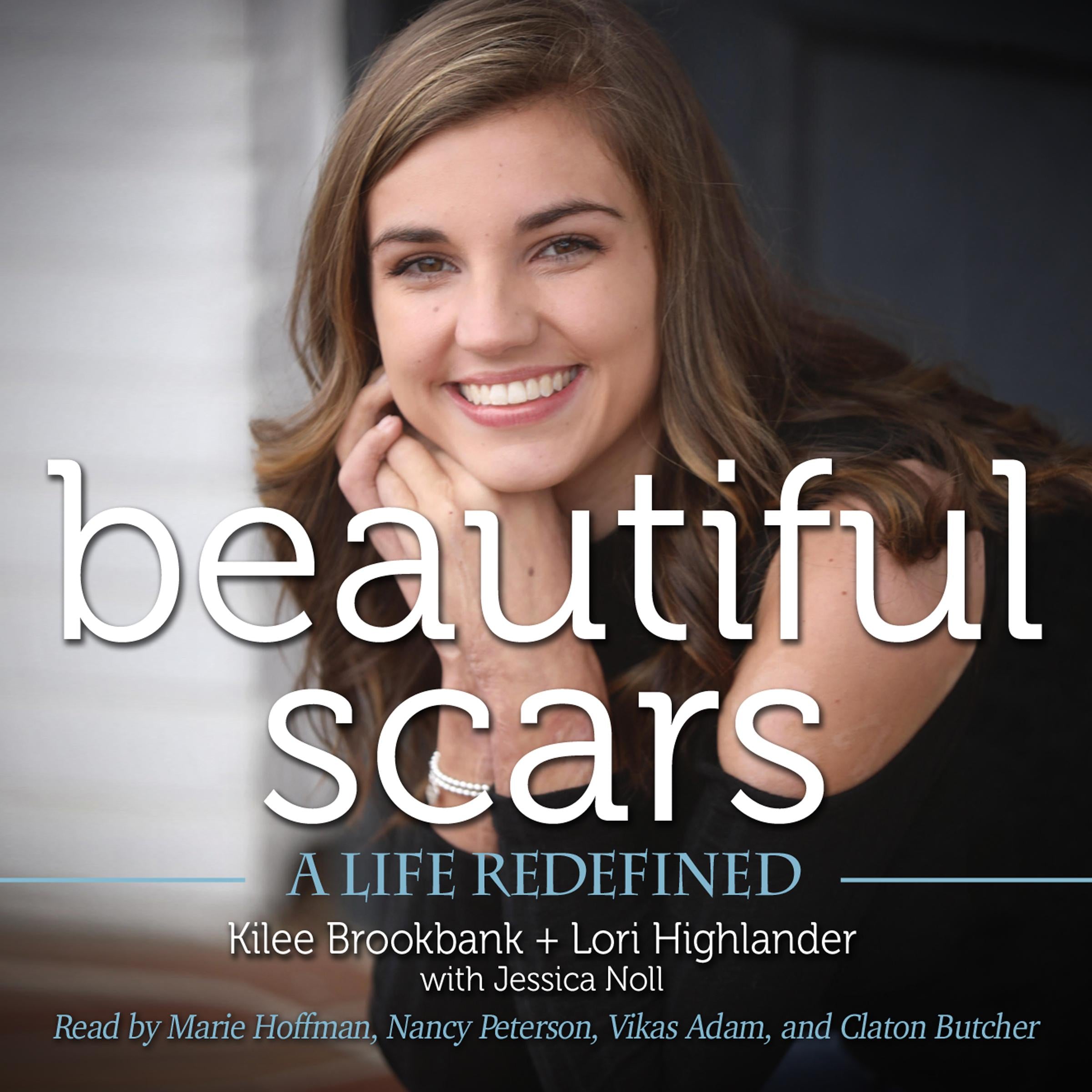 Beautiful Scars