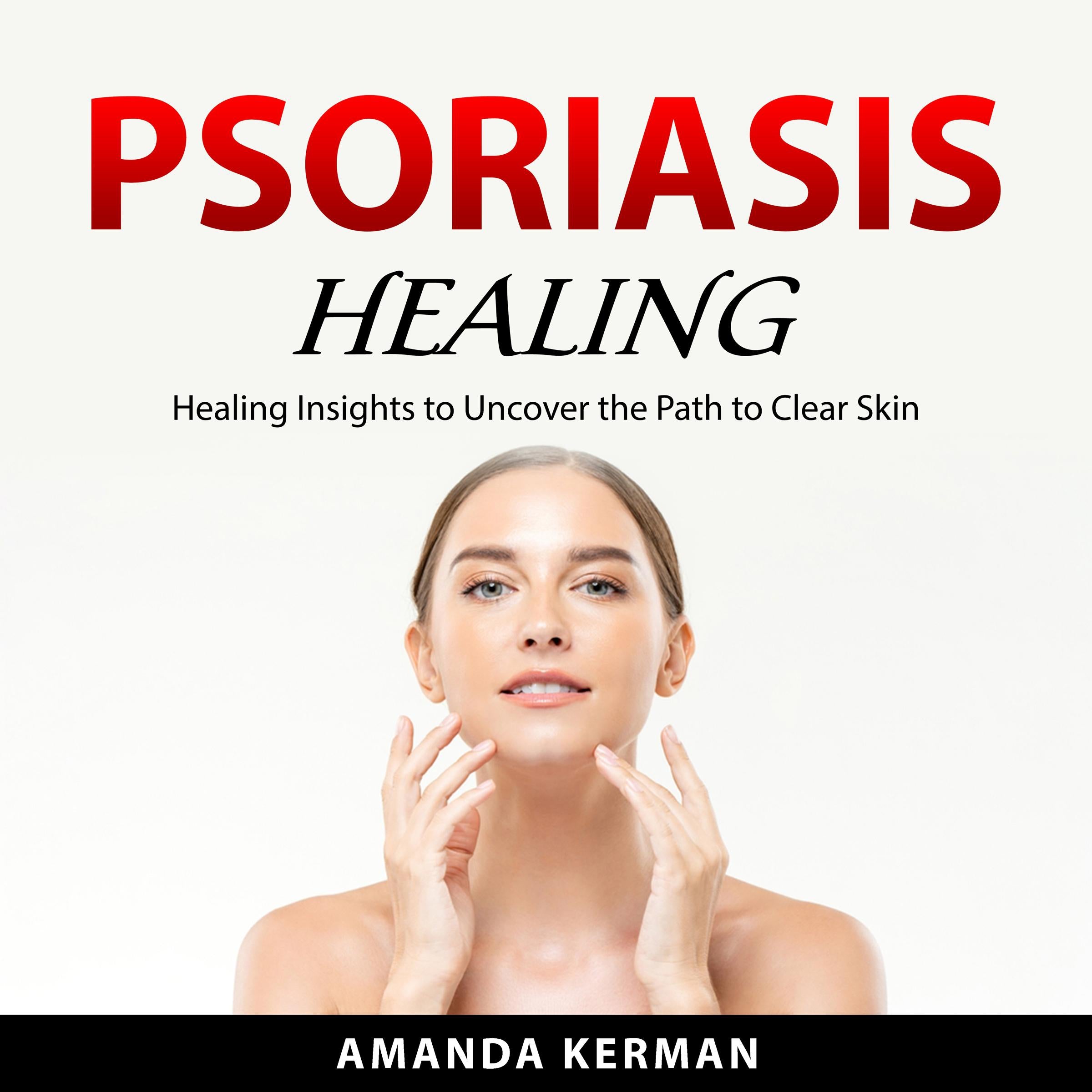 Psoriasis Healing