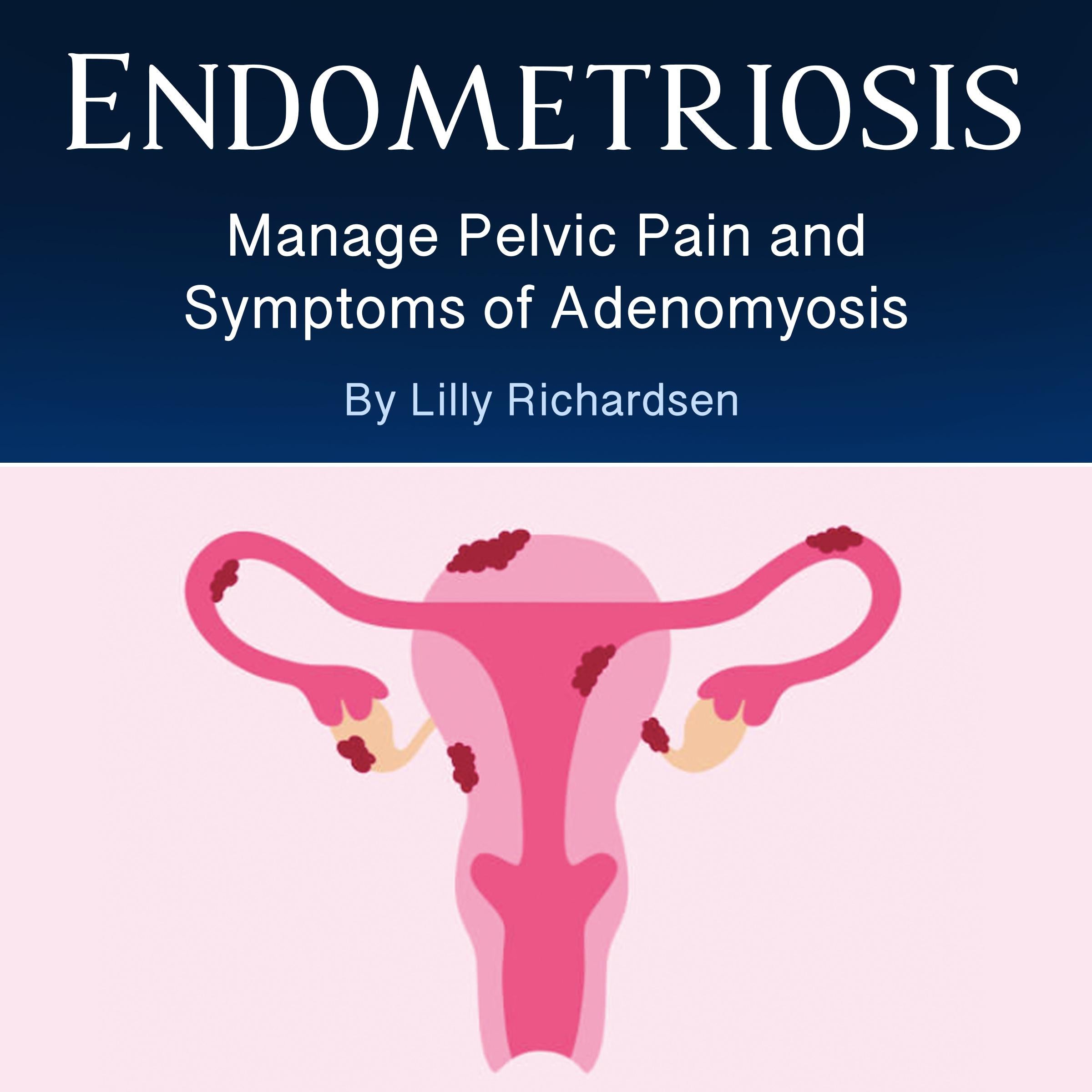 Endometriosis
