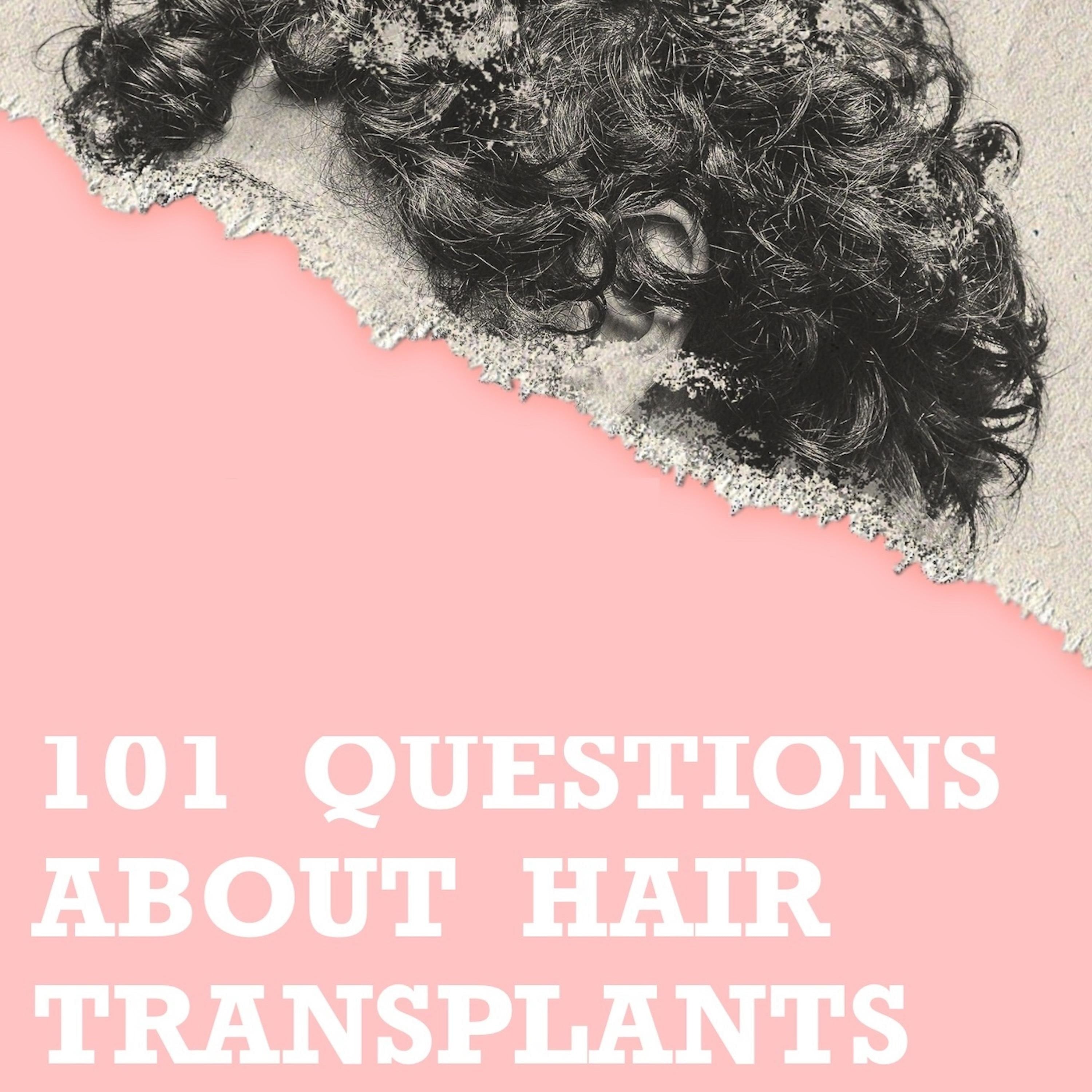 101 questions about hair transplants
