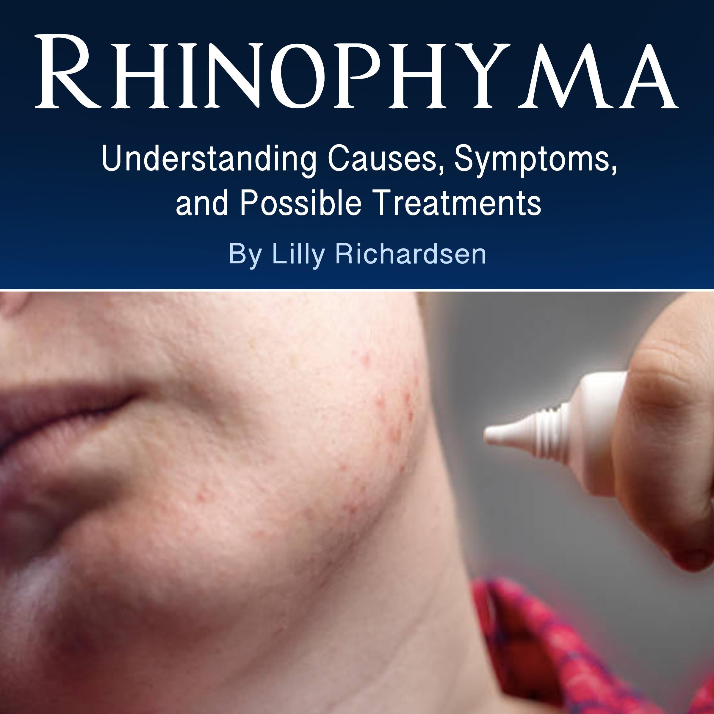 Rhinophyma