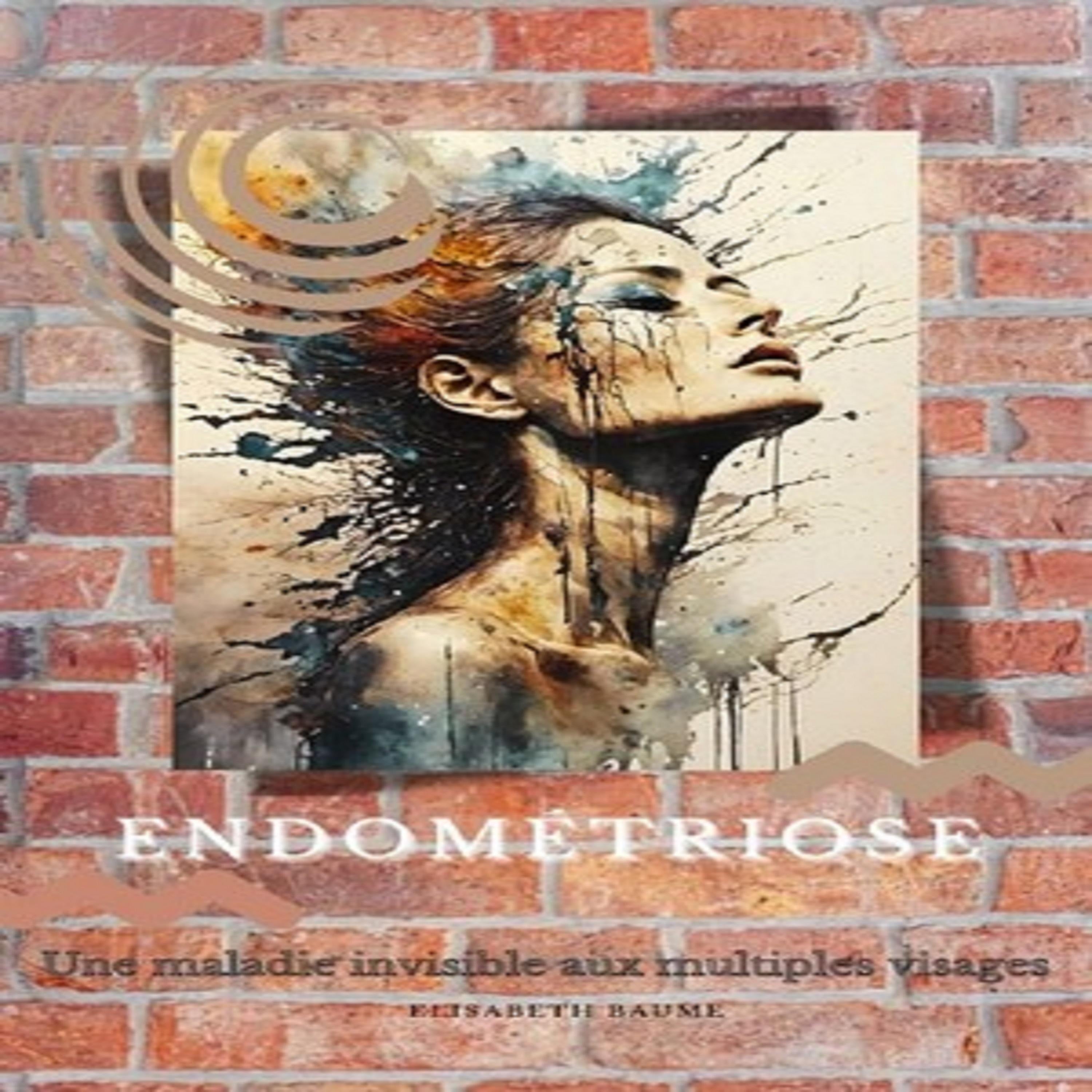 Endométriose