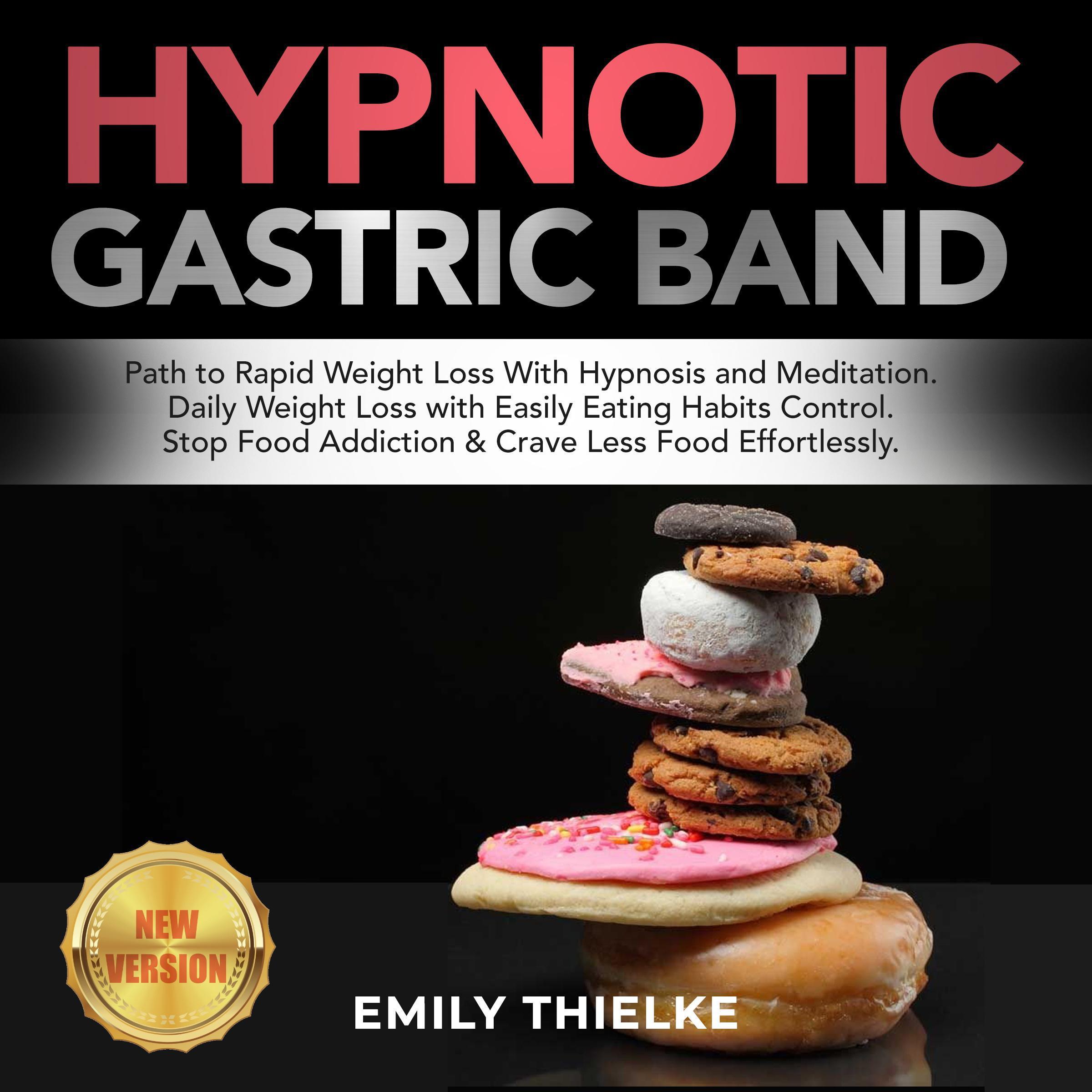 HYPNOTIC GASTRIC BAND