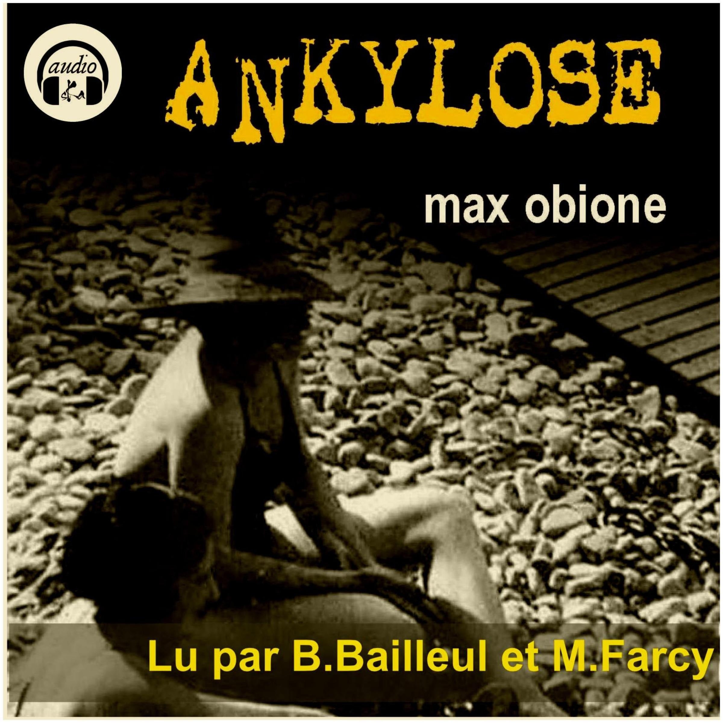 Ankylose