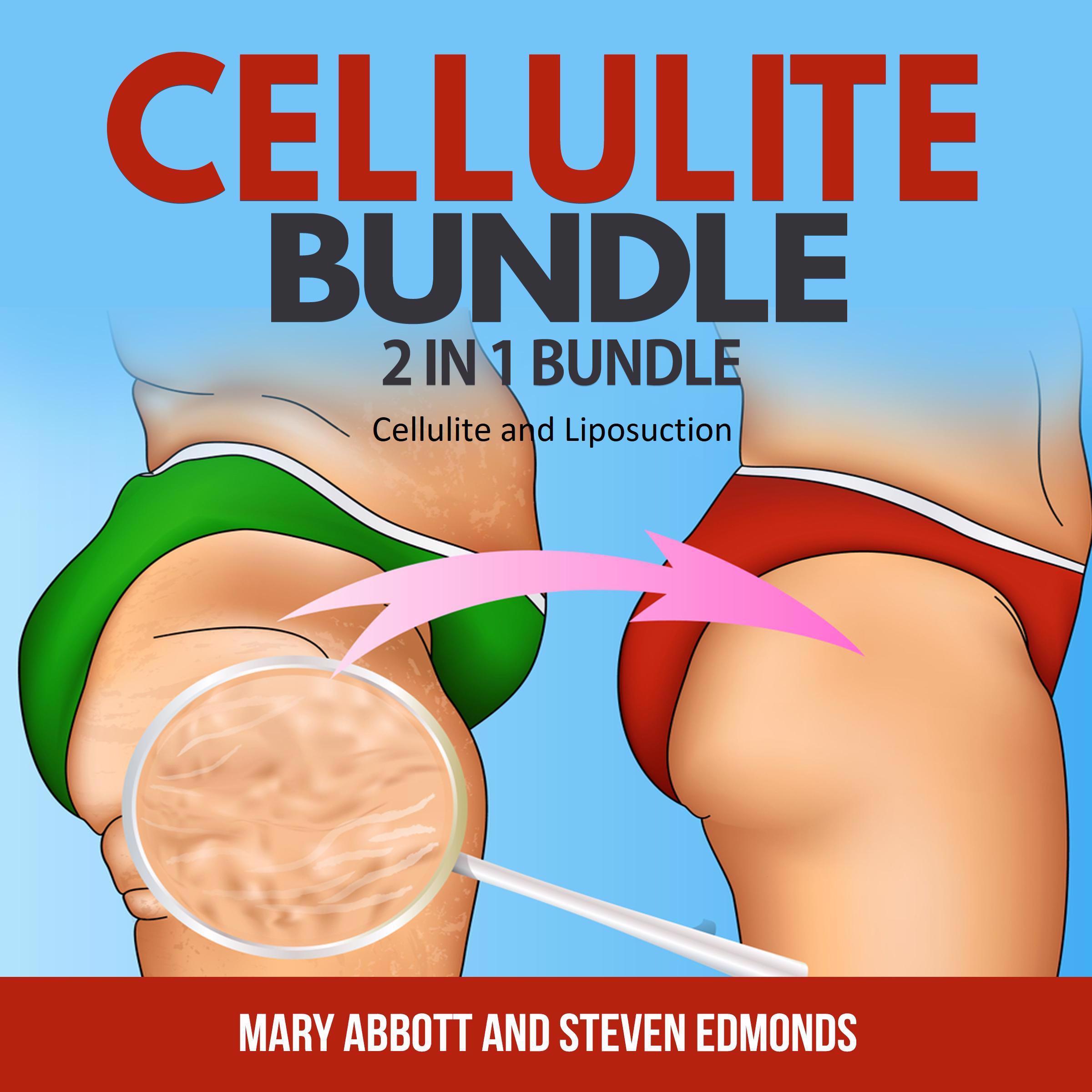 Cellulite Bundle: