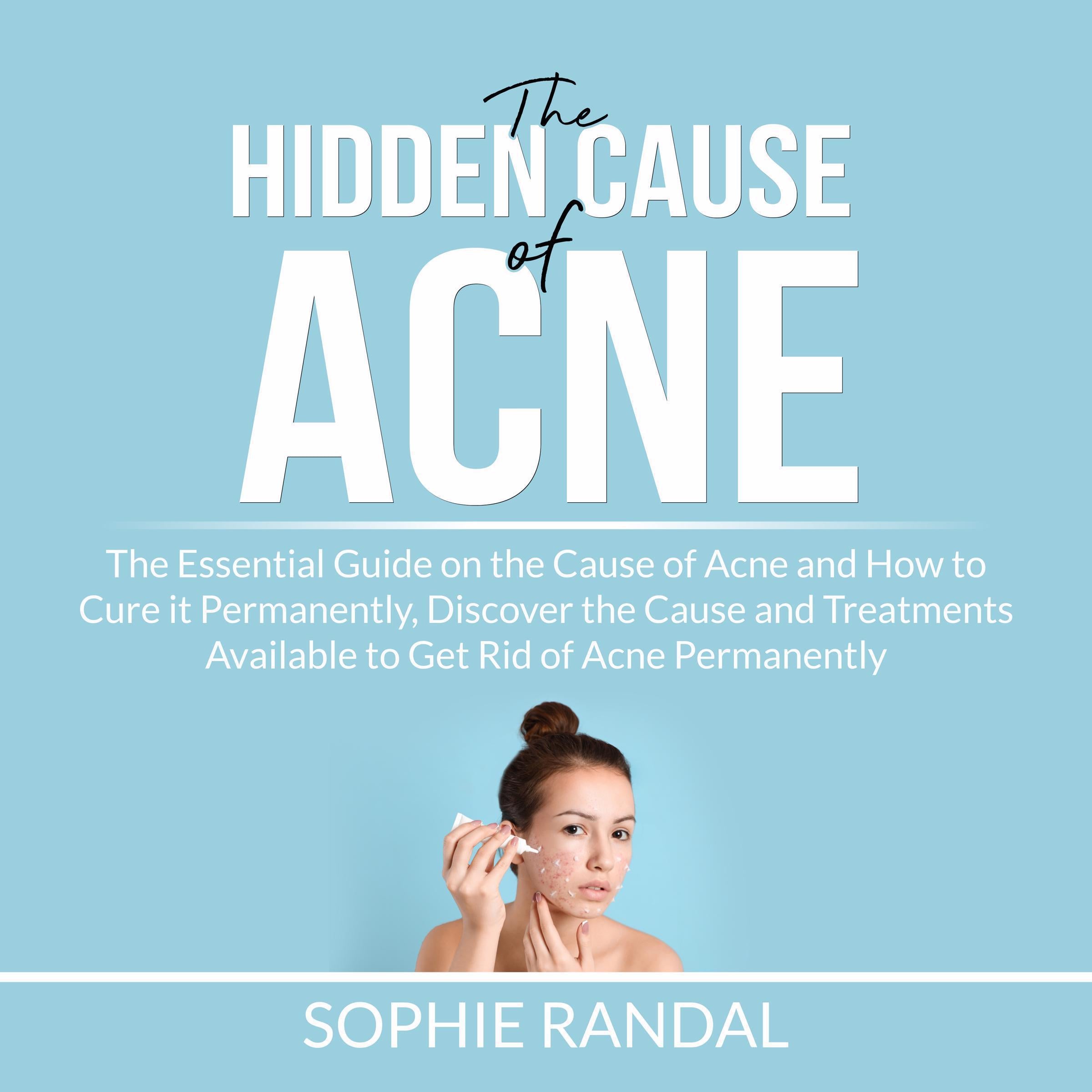 The Hidden Cause of Acne: the Essential Guide on the Cause of Acne and How to Cure it Permanently, Discover the Cause and Treatments Available to Get Rid of Acne Permanently
