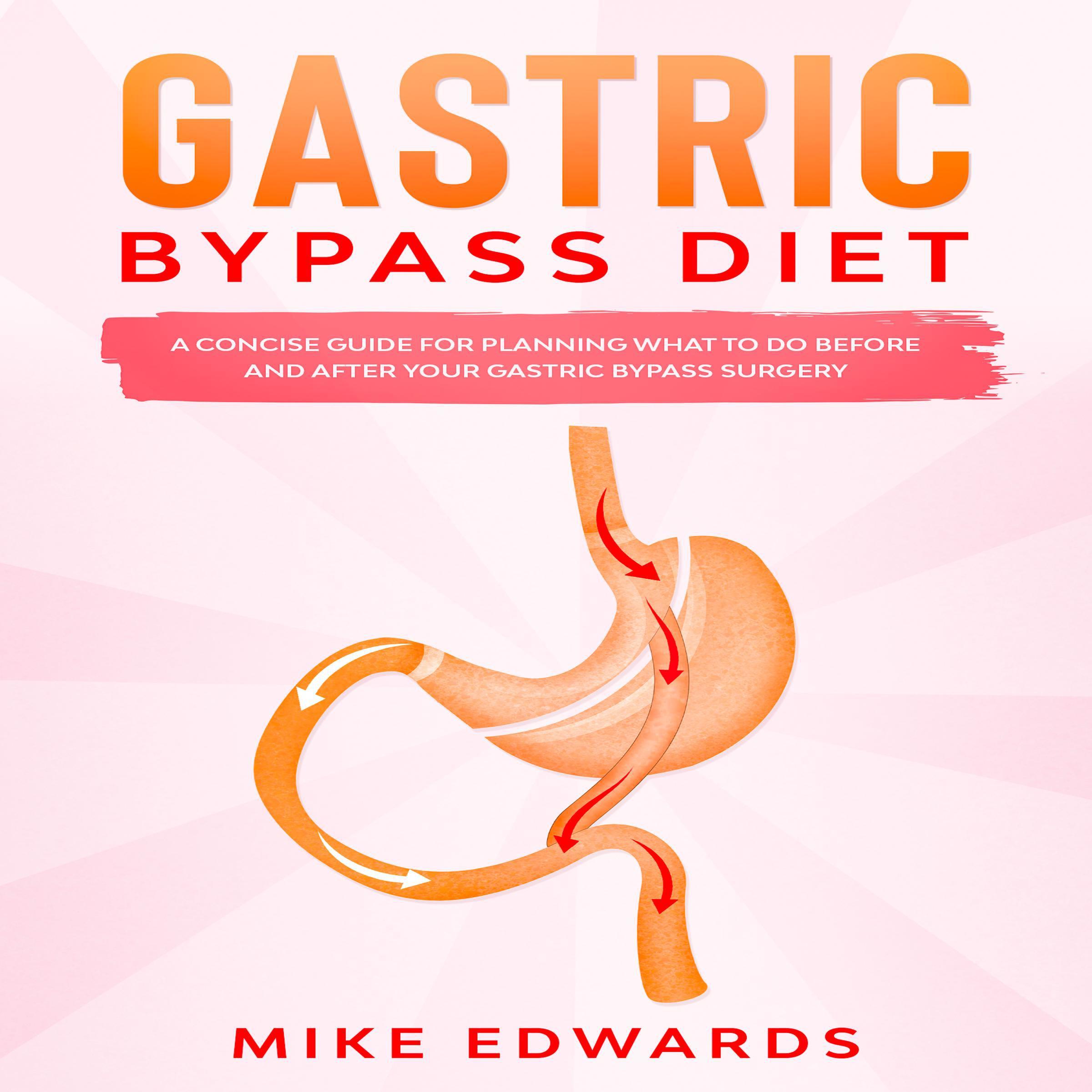 Gastric Bypass Diet: A Concise Guide for Planning What to Do Before and After your Gastric Bypass Surgery