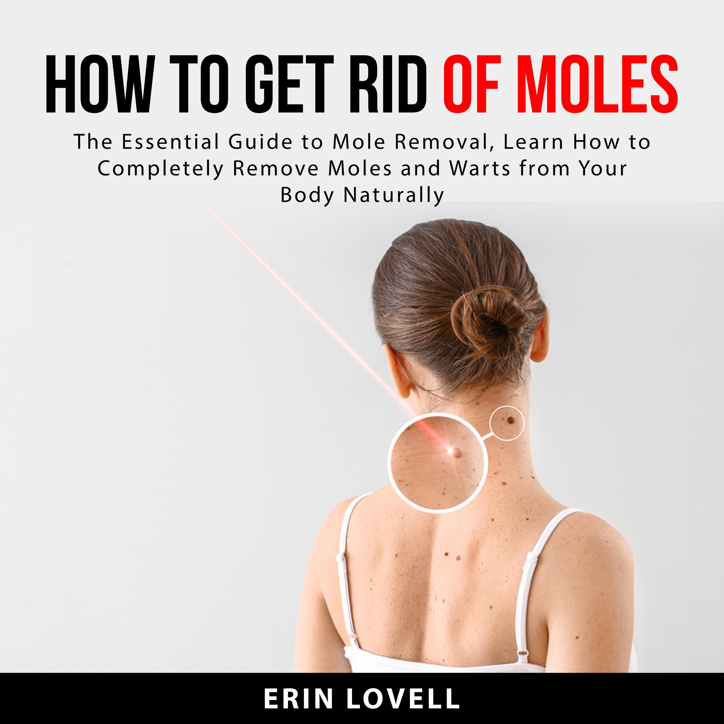 How to Get Rid of Moles