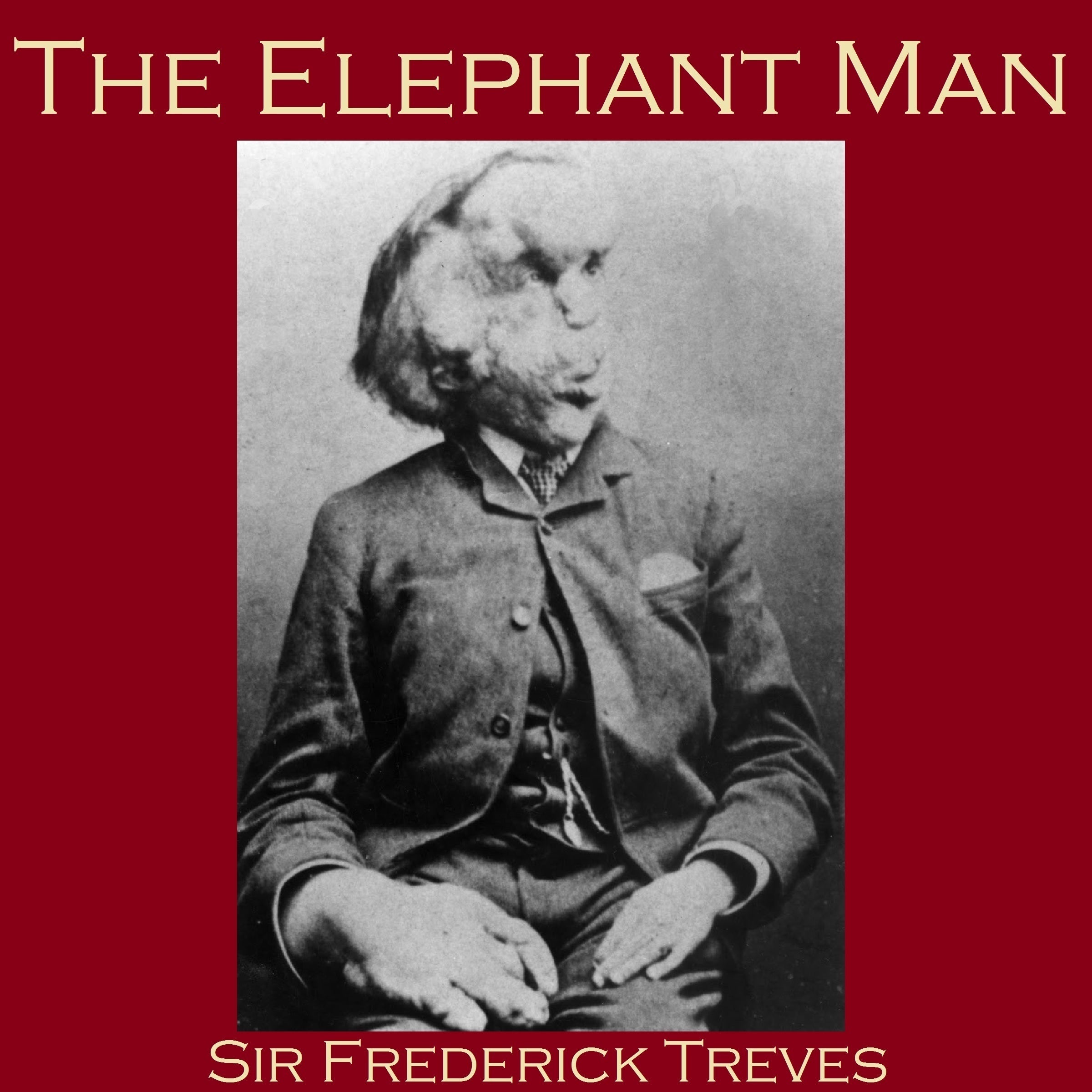The Elephant Man