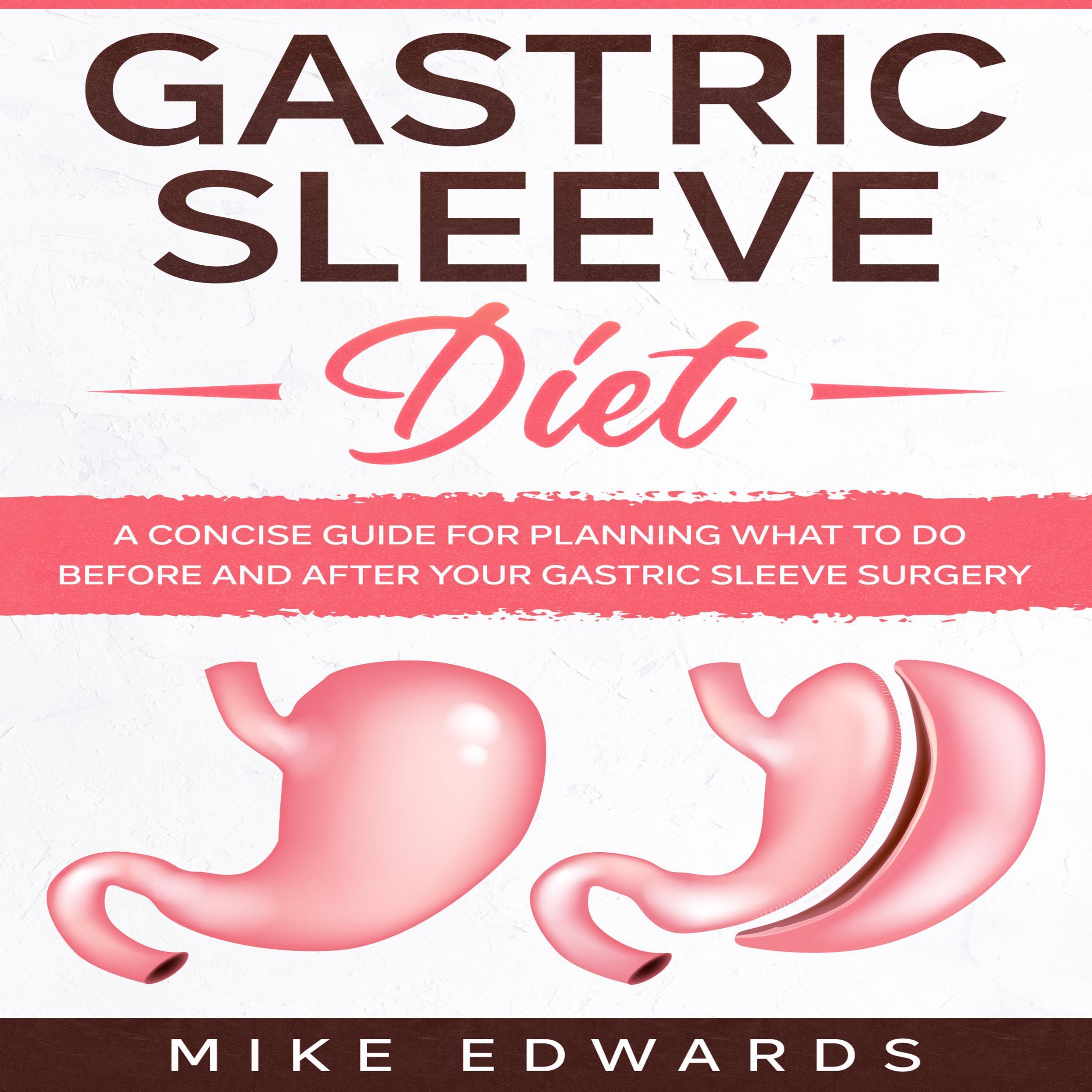 Gastric Sleeve Diet