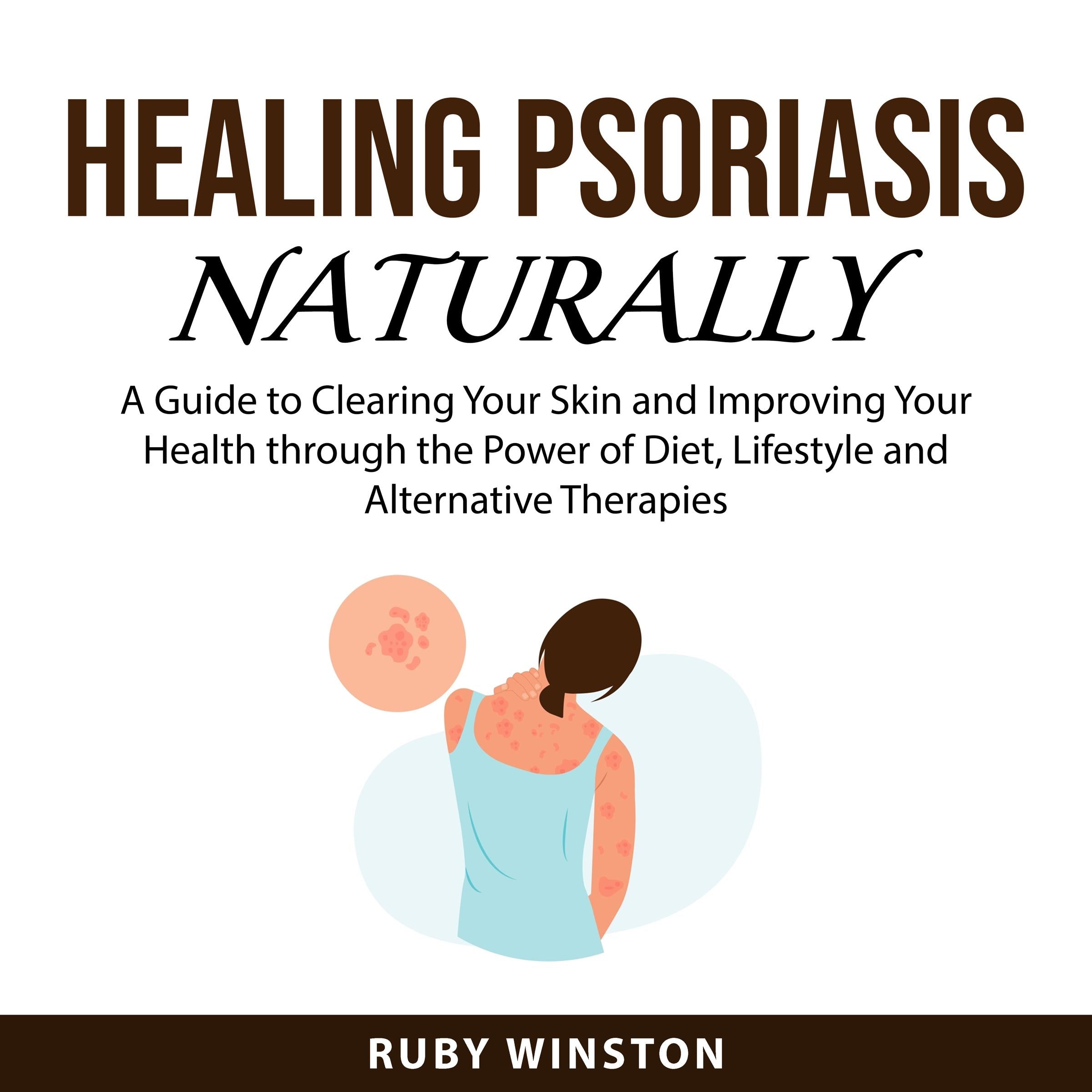 Healing Psoriasis Naturally