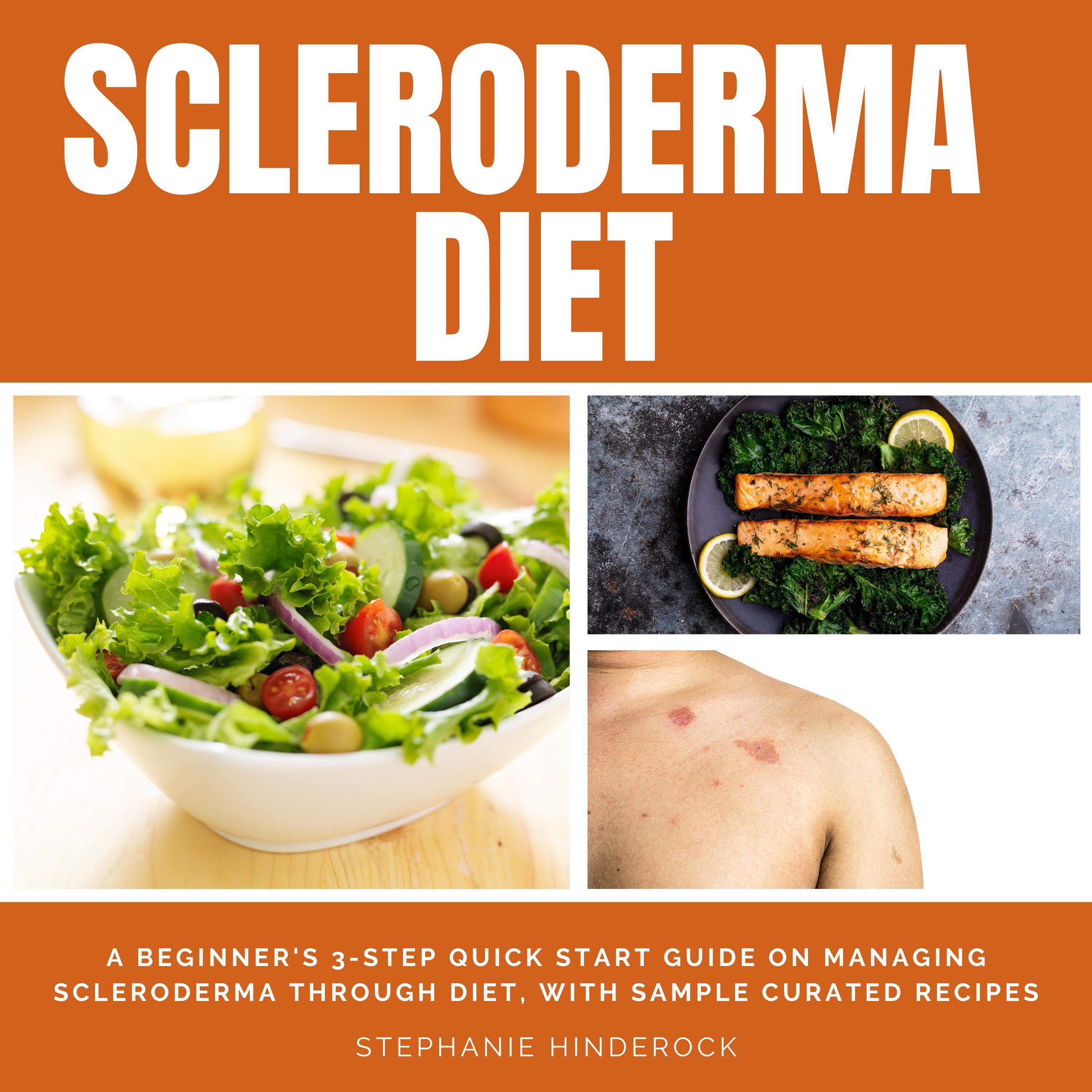 Scleroderma Diet