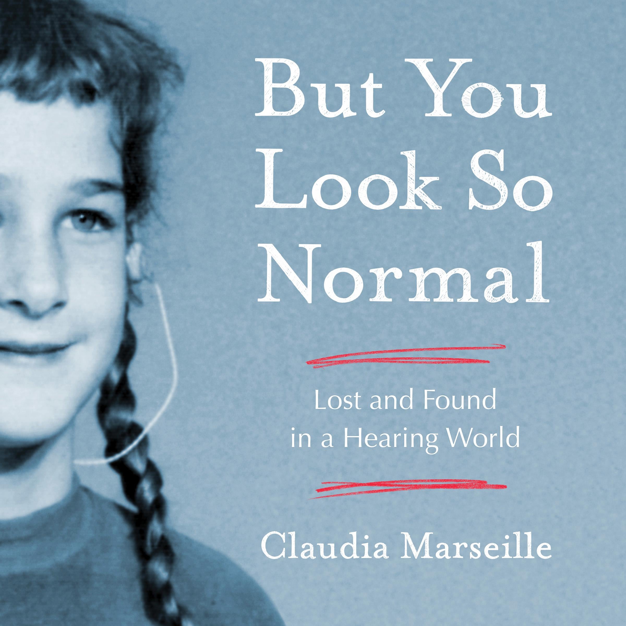 But You Look So Normal