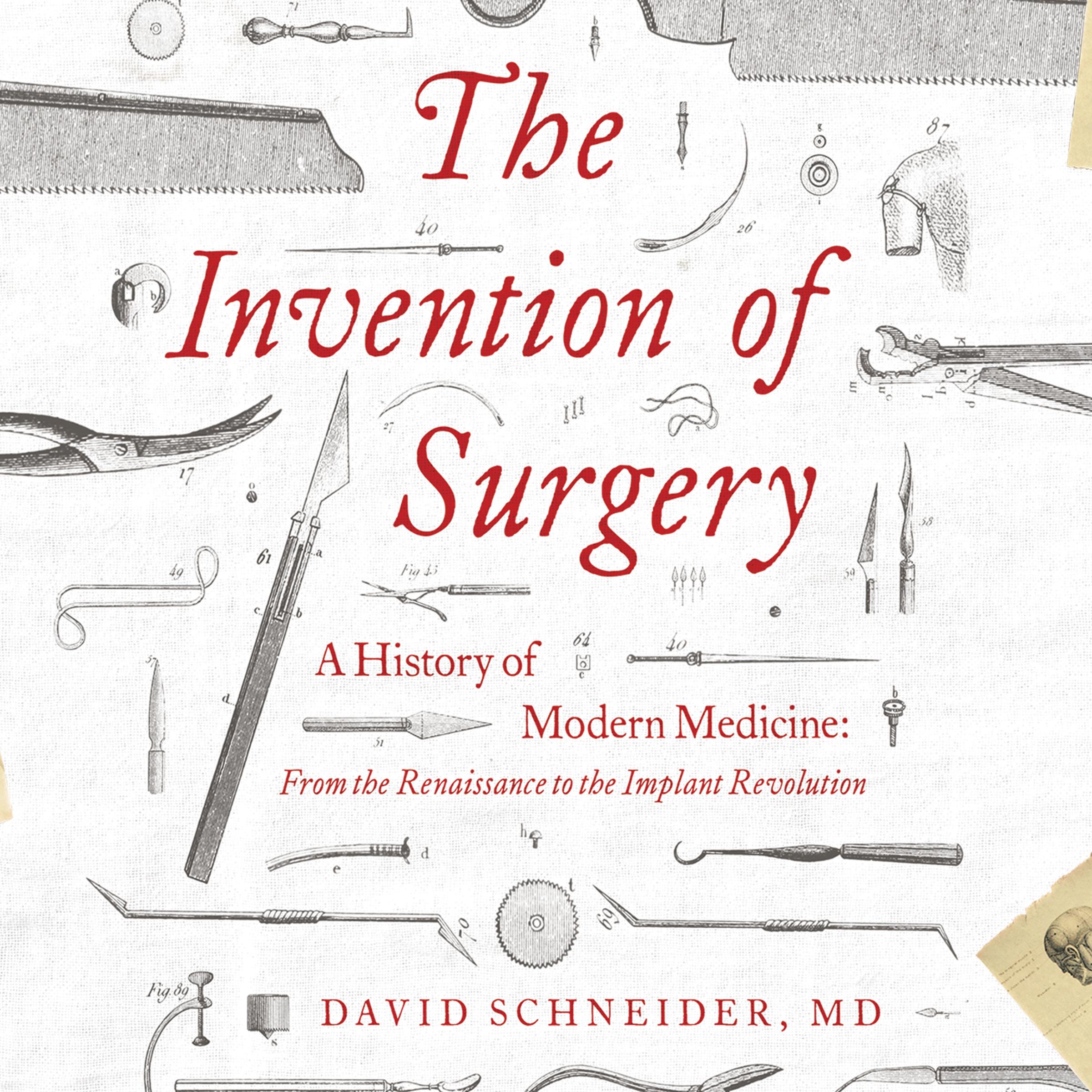 The Invention of Surgery