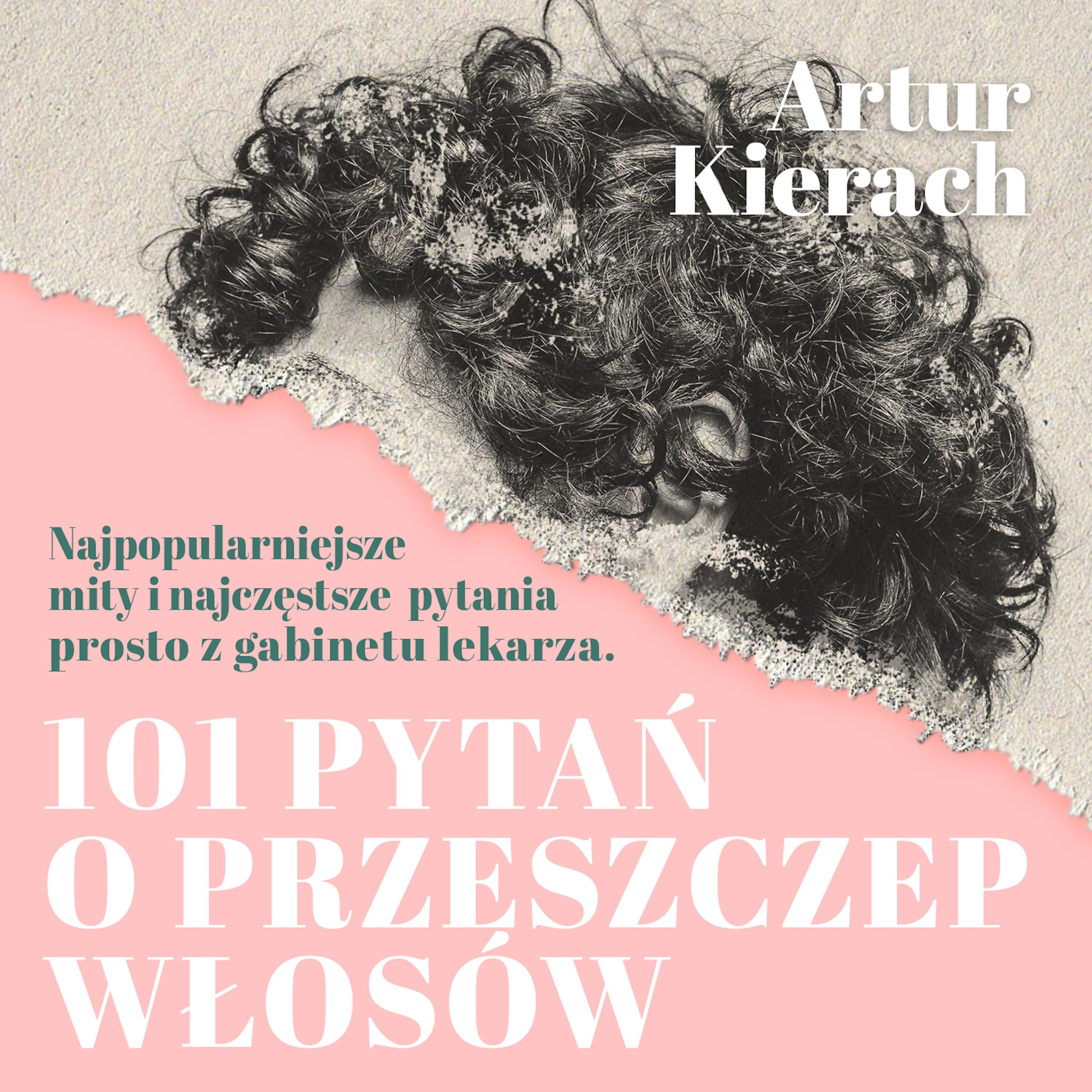 101 pytań o przeszczep włosów