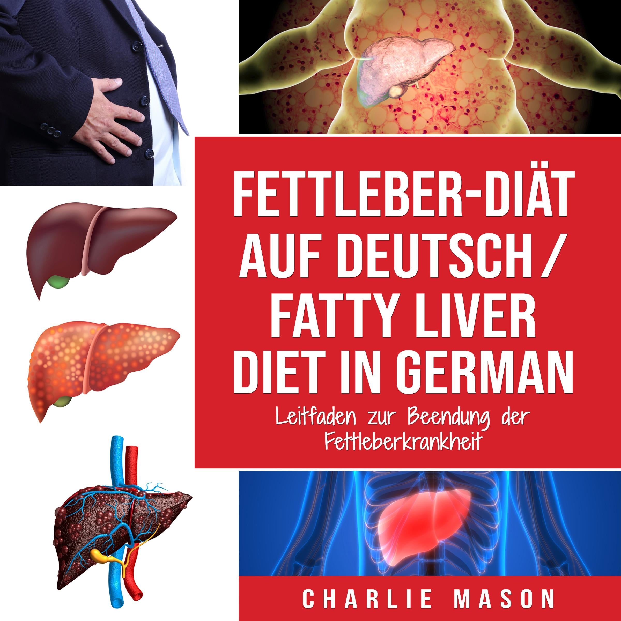 Fettleber-Diät Auf Deutsch/ Fatty liver diet In German: Leitfaden zur Beendung der Fettleberkrankheit (German Edition)