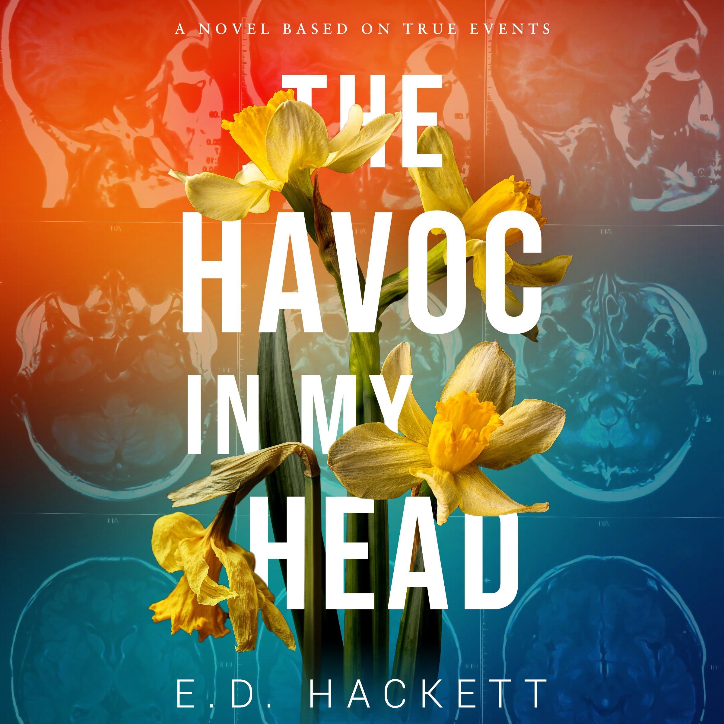 The Havoc in My Head