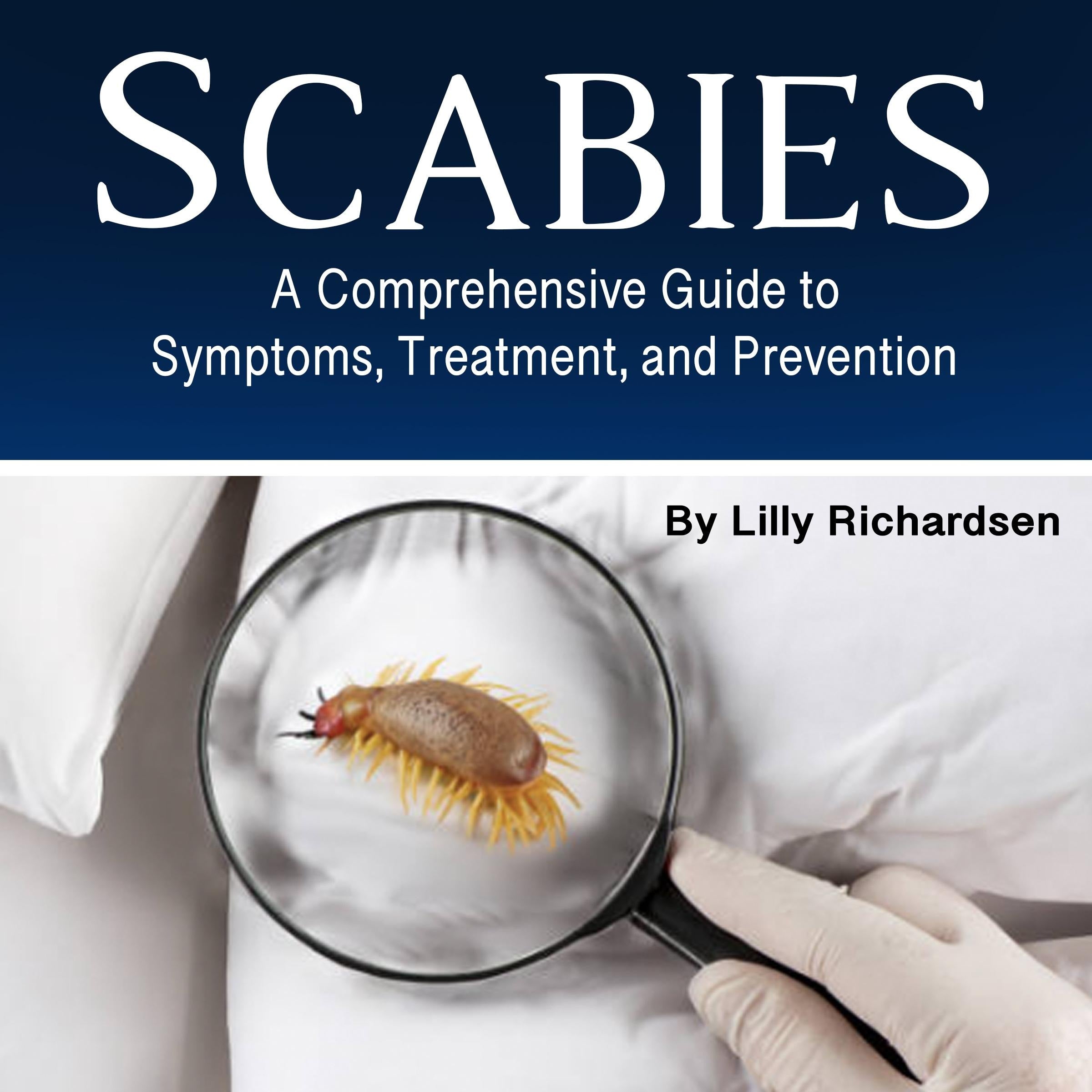 Scabies