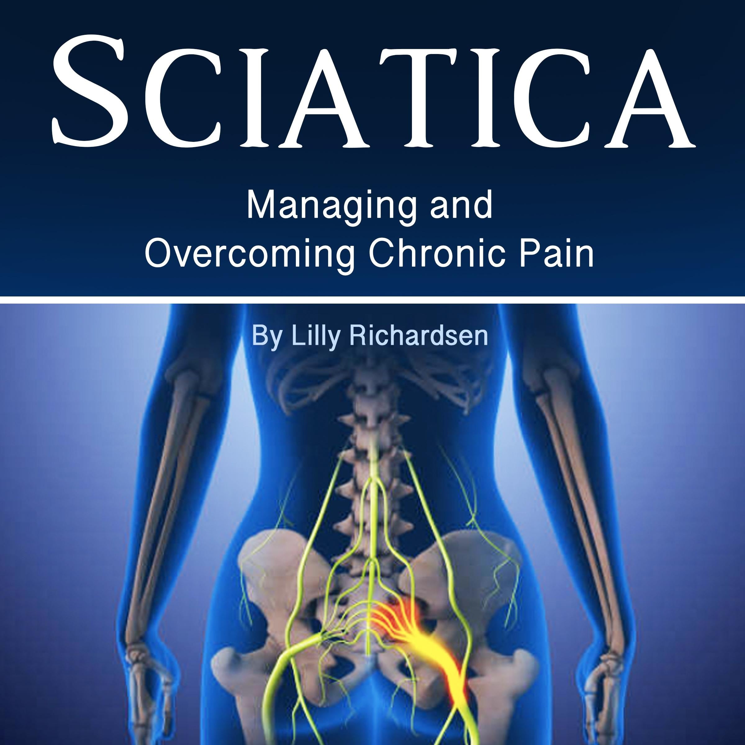 Sciatica