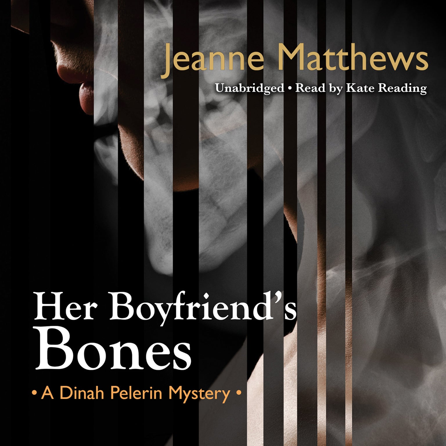 Her Boyfriend's Bones