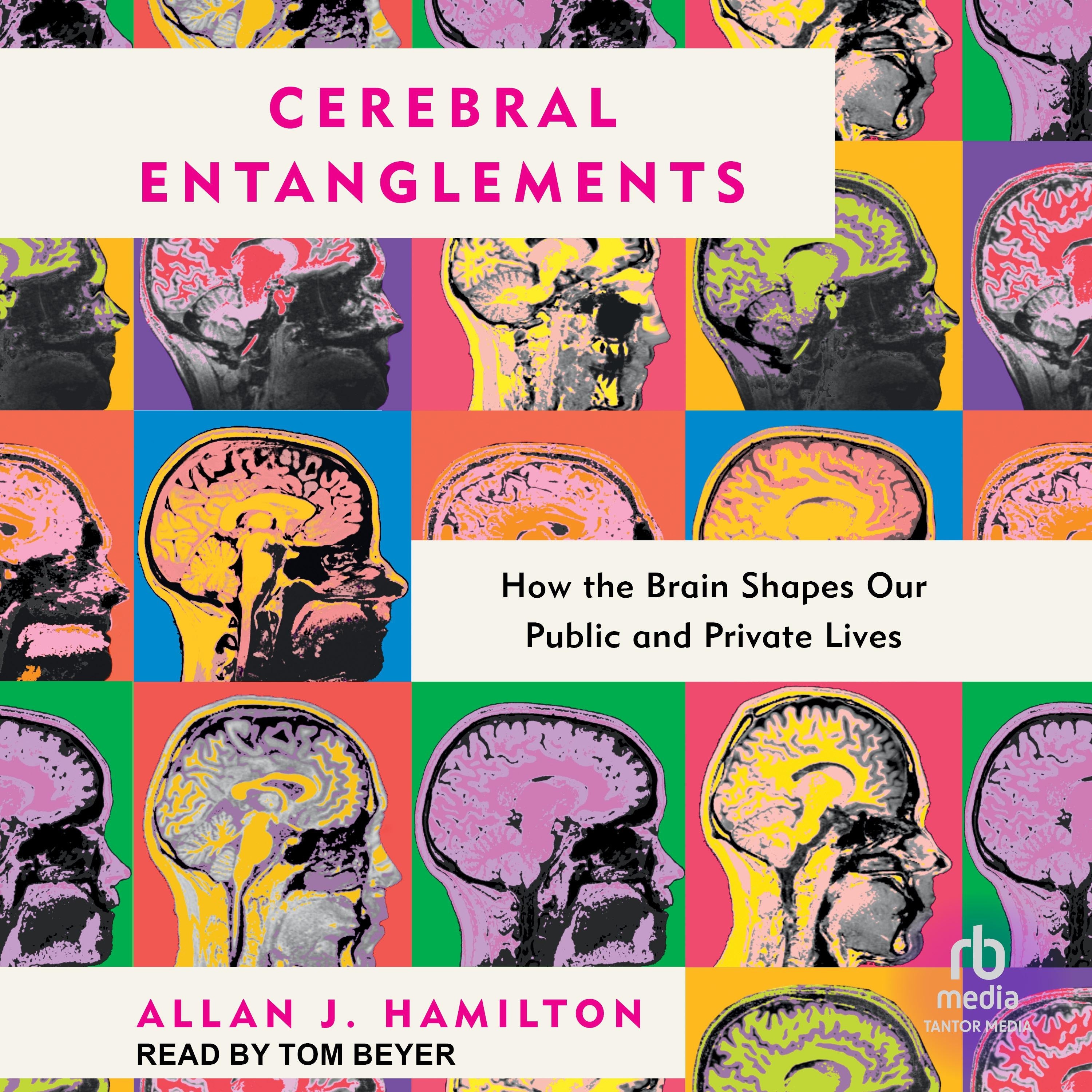 Cerebral Entanglements